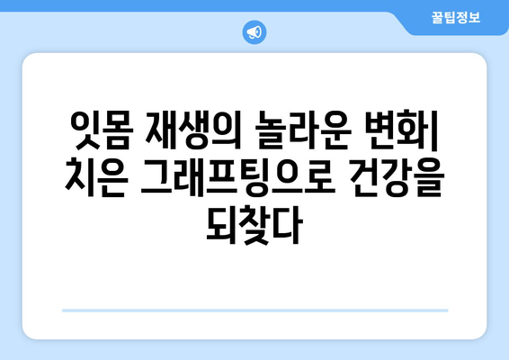 잇몸 재생의 기적| 치은 그래프팅으로 되찾는 건강한 미소 | 치과 치료, 잇몸 질환, 치은 이식, 잇몸 재생, 치과 상담