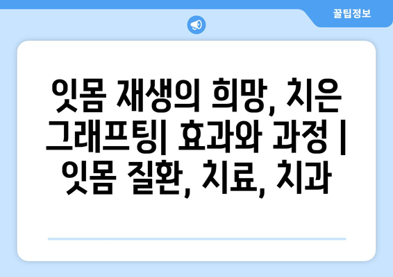 잇몸 재생의 희망, 치은 그래프팅| 효과와 과정 | 잇몸 질환, 치료, 치과