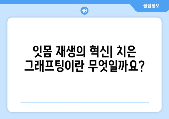 치은 그래프팅으로 되살리는 잇몸| 놀라운 재생의 과학 | 잇몸 재생, 치주 질환, 치과 치료