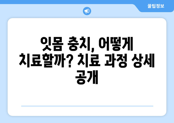 잇몸 충치 치료 경험담| 솔직한 후기와 함께 알아보는 치료 과정 | 잇몸, 충치, 치료, 경험, 후기