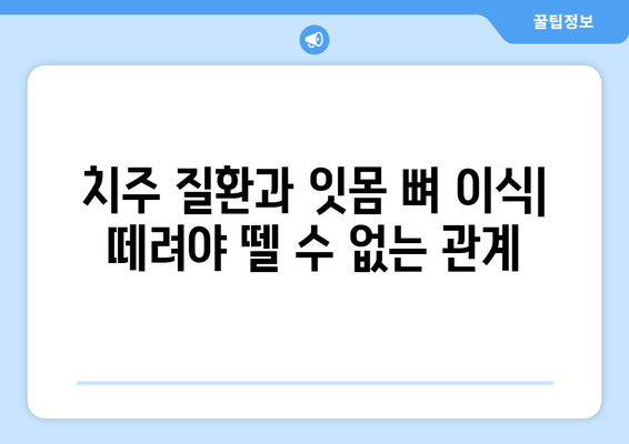 잇몸 뼈 이식 수술| 방법, 유형, 그리고 회복 가이드 | 잇몸 뼈 이식, 임플란트, 치주 질환