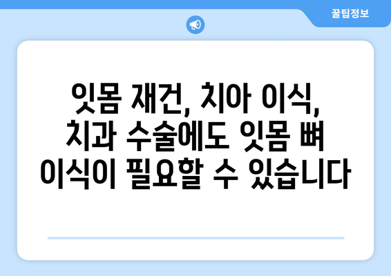 잇몸 뼈 이식| 뼈가 부족할 때 필요한 필수 치료 | 임플란트, 잇몸 재건, 치아 이식, 치과 수술