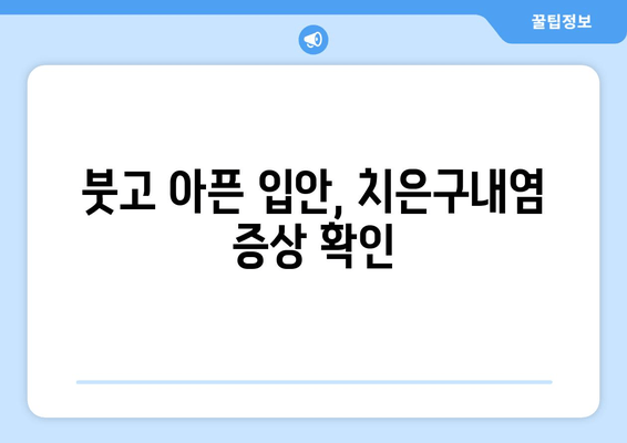 치은구내염 원인 파헤치기| 자주 발생하는 문제 해결 위한 완벽 가이드 | 치은구내염, 원인, 증상, 치료, 예방