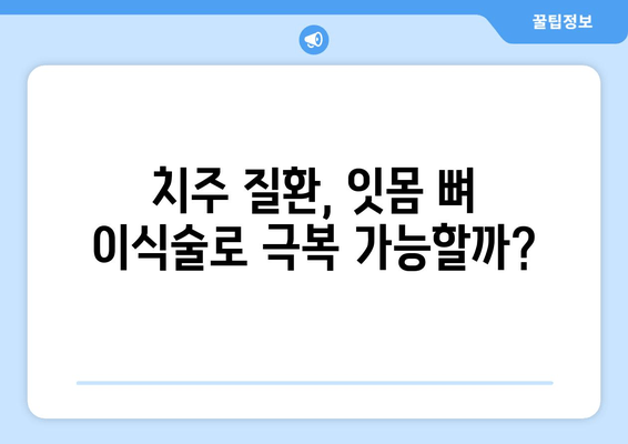 잇몸 뼈 이식술| 다른 방법 비교분석 및 장점 총정리 | 임플란트, 치주 질환, 잇몸 재생