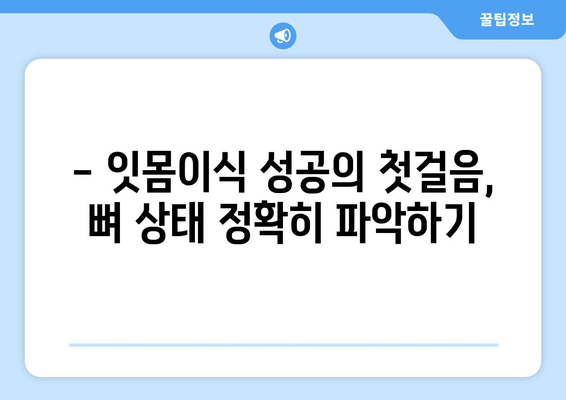 잇몸이식 수술 전 필수! 뼈 상태 확인하는 사전 검사 | 잇몸이식, 뼈 이식, 임플란트, 치주 질환