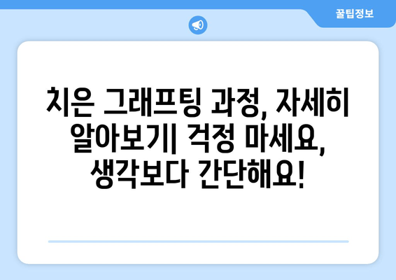 잇몸 내려앉음, 이제 치은 그래프팅으로 해결하세요! | 잇몸 내려앉음 원인, 치료 방법, 치은 그래프팅 과정