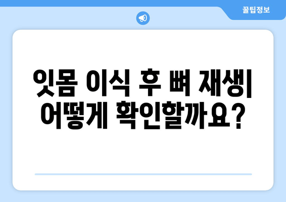 잇몸 이식 수술 후 뼈 상태 확인| 성공적인 회복을 위한 가이드 | 잇몸 이식, 뼈 재생, 치과 치료, 회복 과정