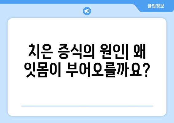 치은 증식 관리| 종합 가이드 | 원인, 증상, 치료, 예방법