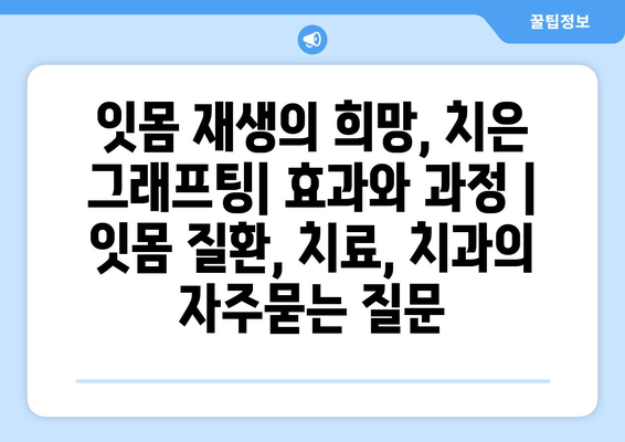 잇몸 재생의 희망, 치은 그래프팅| 효과와 과정 | 잇몸 질환, 치료, 치과