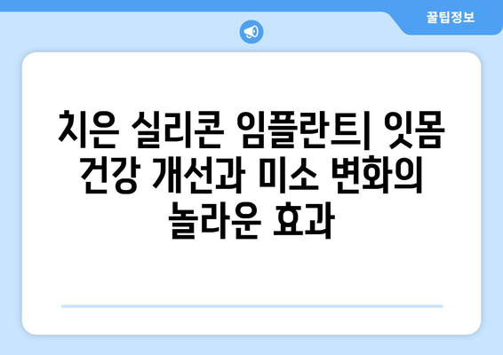 치은 실리콘 임플란트| 치은 건강과 미소의 완벽한 조화 | 치은 건강, 미소 개선, 임플란트 종류