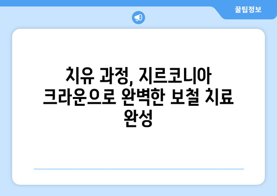 임시치아 후 지르코니아 크라운| 치유 과정과 보철 치료의 모든 것 | 지르코니아 크라운, 임시 치아, 보철 치료, 치과