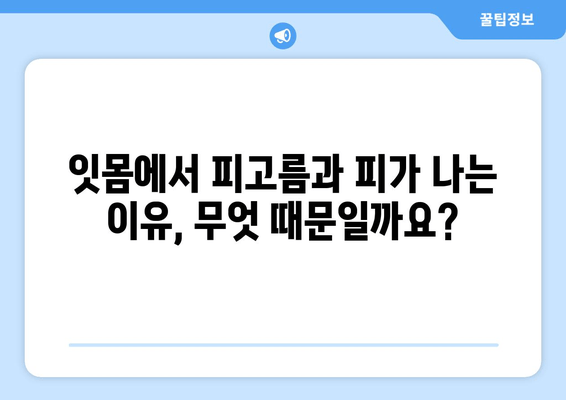 잇몸에서 피고름과 피가 나요? 걱정되는 증상, 원인과 해결책 알아보기 | 잇몸 질환, 치주염, 치과 진료