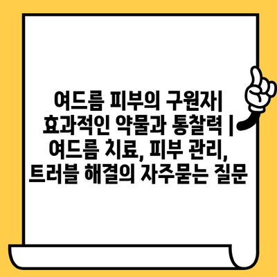 여드름 피부의 구원자| 효과적인 약물과 통찰력 | 여드름 치료, 피부 관리, 트러블 해결