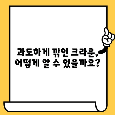 임플란트 크라운 길이 조정, 과도하게 깎였을 때 해결책은? | 임플란트, 크라운, 재수술, 치과