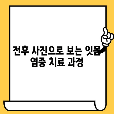 앞니 임플란트 & 크라운 재치료 후 잇몸 염증? 전후 사진과 함께 해결책 찾기 | 임플란트, 크라운, 잇몸염증, 치료