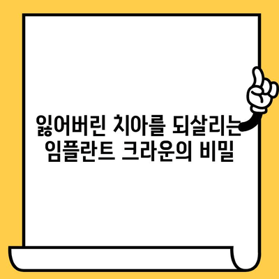 임플란트 크라운의 과학적 탐구| 치과 진료의 진화 | 임플란트, 크라운, 치과, 치료, 기술