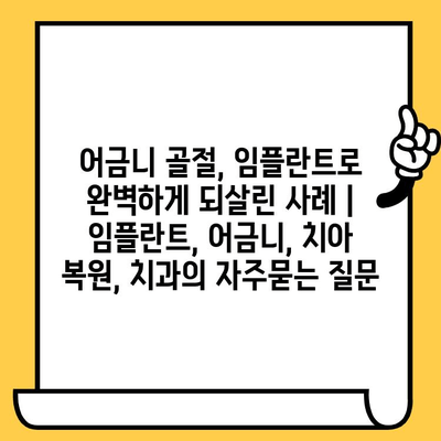 어금니 골절, 임플란트로 완벽하게 되살린 사례 | 임플란트, 어금니, 치아 복원, 치과