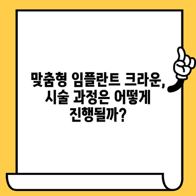 맞춤형 임플란트 크라운| 장점과 비용 완벽 가이드 | 임플란트, 치과, 가격, 시술