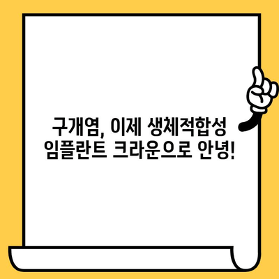 생체적합성 임플란트 크라운, 구개염 예방의 새로운 해결책 | 임플란트, 구강 건강, 치과