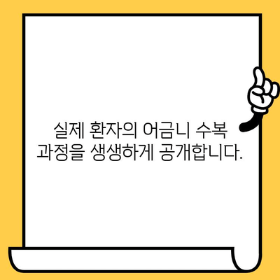 어금니 부러짐, 임플란트 & 크라운으로 완벽하게 회복! 실제 수복 사례 공개 | 어금니, 임플란트, 크라운, 치과, 수복, 사례, 치료 과정