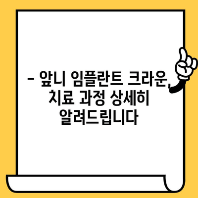 앞니 임플란트 크라운, 치료 후기 & 주의사항 | 임플란트, 크라운, 앞니, 치과