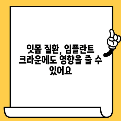 임플란트 크라운, 4가지 주요 단점 알아보기 | 임플란트, 치과, 치료, 비용, 장단점