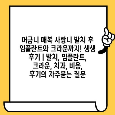 어금니 매복 사랑니 발치 후 임플란트와 크라운까지! 생생 후기 | 발치, 임플란트, 크라운, 치과, 비용, 후기