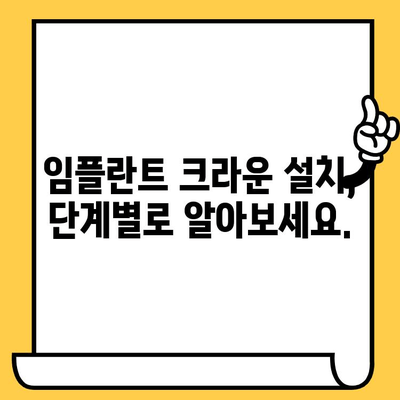 임플란트 크라운 설치, 단계별 완벽 가이드 | 임플란트, 크라운, 치과, 치료