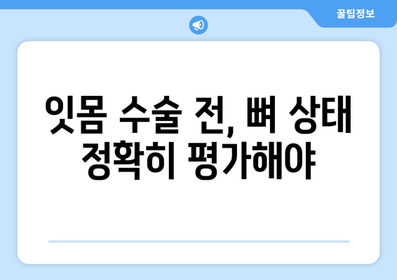 잇몸 수술 성공의 시작, 뼈 상태 평가가 중요한 이유 | 잇몸 수술, 뼈 이식, 임플란트, 치주 질환