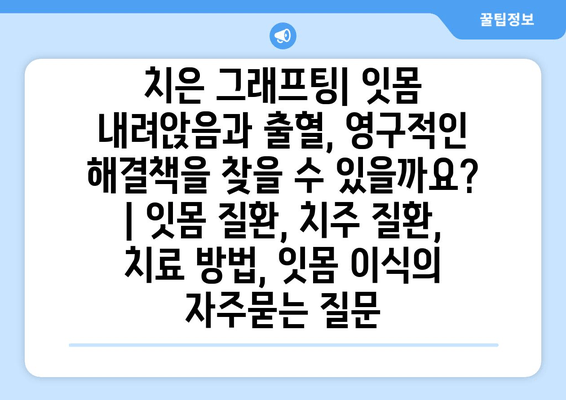 치은 그래프팅| 잇몸 내려앉음과 출혈, 영구적인 해결책을 찾을 수 있을까요? | 잇몸 질환, 치주 질환, 치료 방법, 잇몸 이식