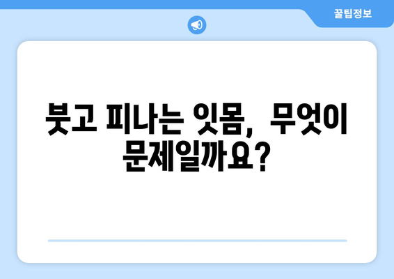 잇몸 붓기와 출혈, 이렇게 대처하세요! | 잇몸 질환, 치료, 예방, 관리