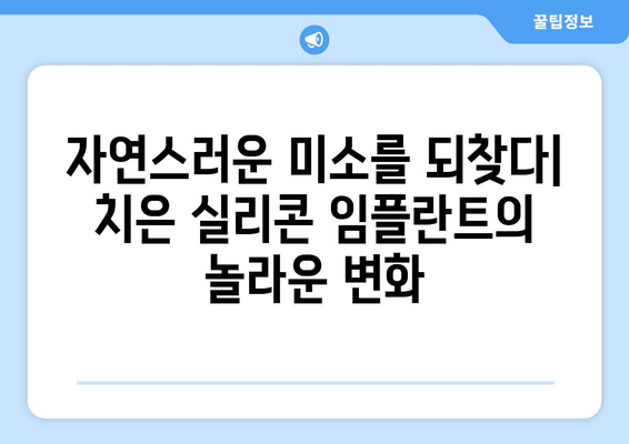 치은 실리콘 임플란트| 내구성과 자연스러움의 완벽한 조화 | 장점, 단점, 가격 비교, 후기