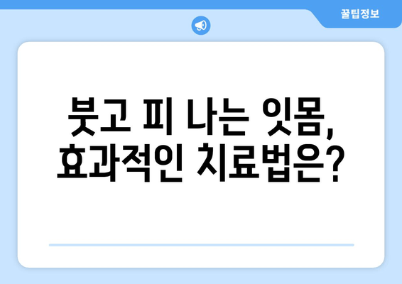 붓고 피가 나는 잇몸| 원인과 효과적인 대처 방법 | 잇몸 질환, 치주염, 치료, 예방