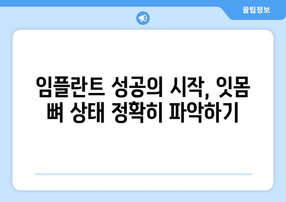 임플란트 성공 위한 필수! 잇몸 뼈 상태 정확히 진단하는 방법 | 임플란트, 잇몸 뼈, 진단, 검사, 성공률