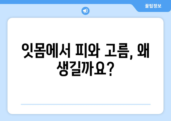 잇몸 피나고름| 원인과 해결책, 치료까지 | 잇몸 질환, 치주염, 잇몸 건강