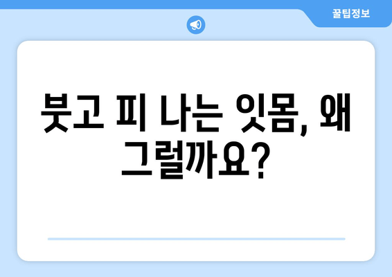 붓고 피가 나는 잇몸| 원인과 효과적인 대처 방법 | 잇몸 질환, 치주염, 치료, 예방