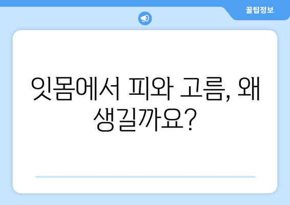 잇몸 피와 고름, 걱정되시나요? 원인과 해결책 알아보기 | 잇몸 질환, 치주염, 치과 치료