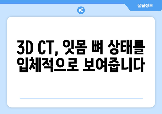 임플란트 성공 위한 필수! 잇몸 뼈 상태 정확히 진단하는 방법 | 임플란트, 잇몸 뼈, 진단, 검사, 성공률