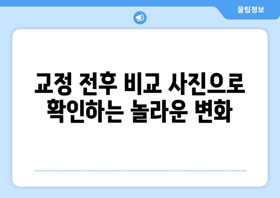 명동치과에서 찾는 아름다운 미소, 나에게 맞는 치아교정 | 명동, 치아교정, 교정전후, 비용, 후기